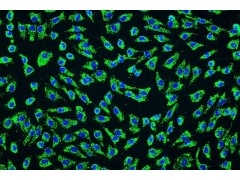 周边细胞培养基 PM sciencell图1